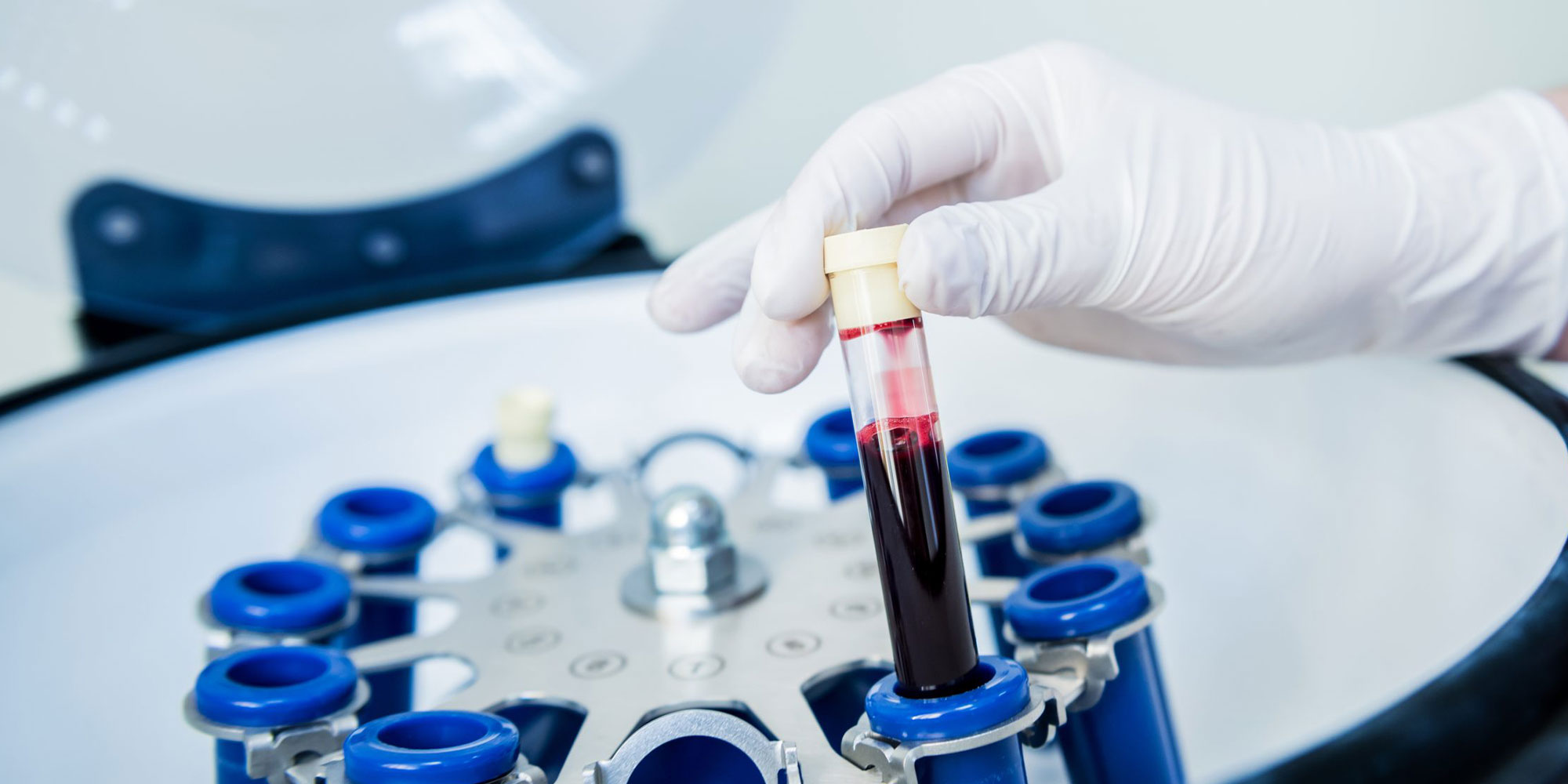 tubes if PRF for cosmetic treatment