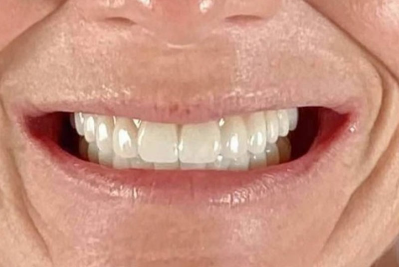 close up of before and after procedure