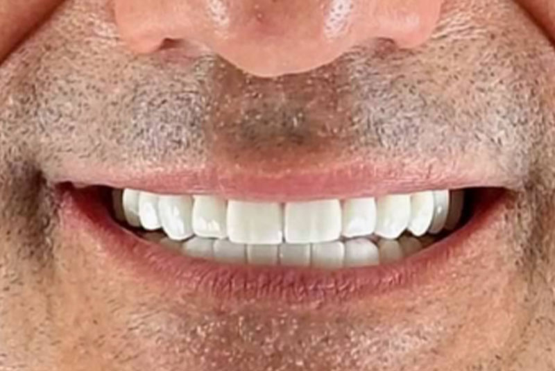 close up of before and after procedure