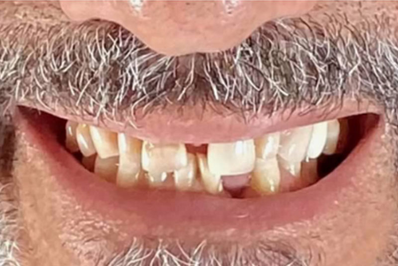 close up of before and after procedure