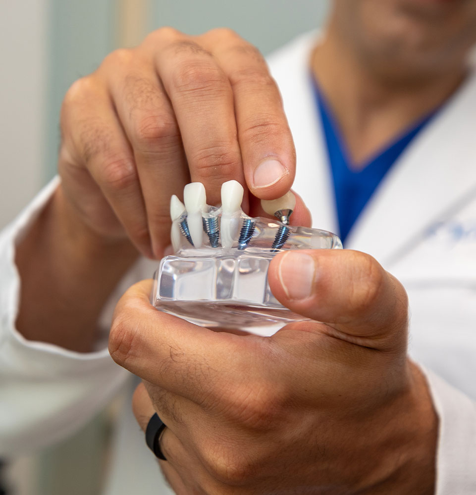 close up of full arch model